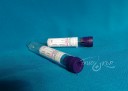 Пробирка вакуумная Фиолетовая крышка с антикоагулянтом КЗ ЭДТА 9 мл гематология крови
